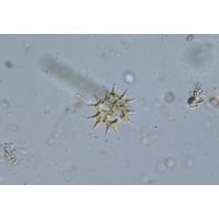Pediastrum duplex