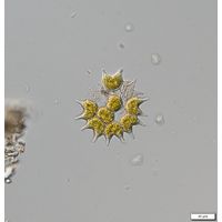 Pseudopediastrum boryanum