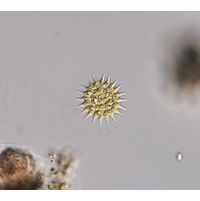 Pseudopediastrum boryanum