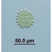 Pseudopediastrum boryanum