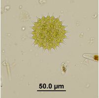 Pseudopediastrum boryanum