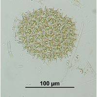 Pseudopediastrum boryanum