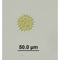 Pseudopediastrum boryanum