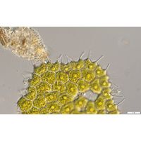 Pseudopediastrum forcipatum