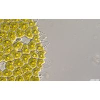 Pseudopediastrum forcipatum