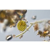 Pseudopediastrum forcipatum