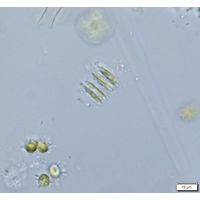 Quadrigula closterioides
