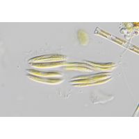 Quadrigula closterioides