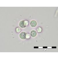 Radiococcus wildermannii