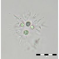 Radiococcus wildermannii