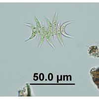Tetradesmus lagerheimii