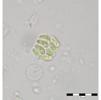 Scenedesmus cf. obtusus var. disciformis