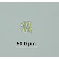 Scenedesmus obtusus var. disciformis