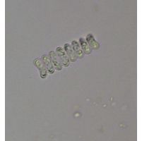 Scenedesmus ellipticus