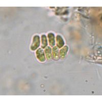 Scenedesmus obtusus var. disciformis