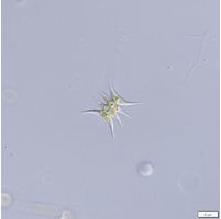 Tetradesmus lagerheimii