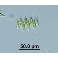 Tetradesmus obliquus