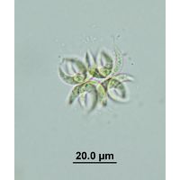 Selenastrum bibraianum
