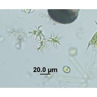 Selenastrum bibraianum