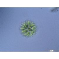 Sorastrum spinulosum