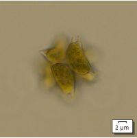 Sorastrum spinulosum