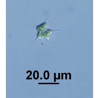 Tetraedron caudatum