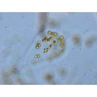 Tetraspora gelatinosa