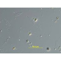 Treubaria planctonica