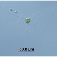 Treubaria schmidlei