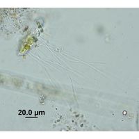 Aphanochaete repens