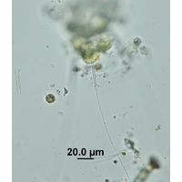 Aphanochaete repens