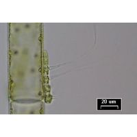 Aphanochaete sp.