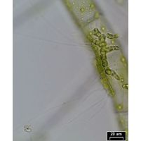 Aphanochaete sp. 