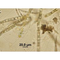Aphanochaete sp.