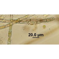 Aphanochaete sp.