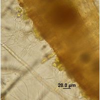 Aphanochaete sp.