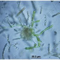 Aphanochaete sp.