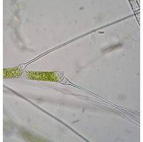 Bulbochaete