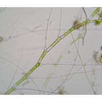 Bulbochaete