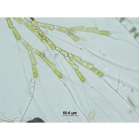 Bulbochaete sp.
