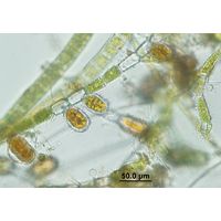 Bulbochaete sp.