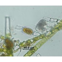 Bulbochaete sp.
