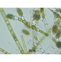 Bulbochaete sp.
