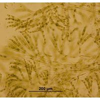 Chaetophora lobata