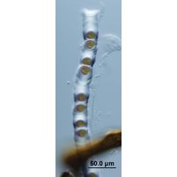 Cylindrocapsa geminella
