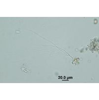 Dicranochaete sp.