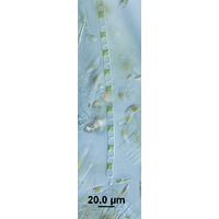 cf. Microspora stagnorum