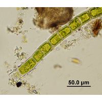 Microspora sp. 