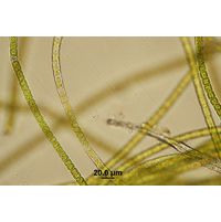Microspora sp. 