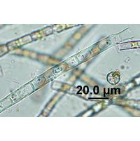 Microspora sp. 